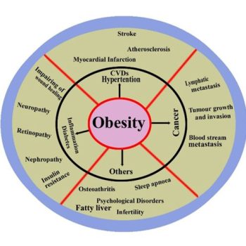 Obesity 1